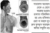 শীতের ব্রঙ্কাইটিস ও হূদরোগ