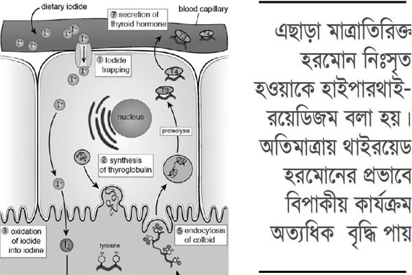 থাইরয়েড হরমোন যখন অতিমাত্রায়