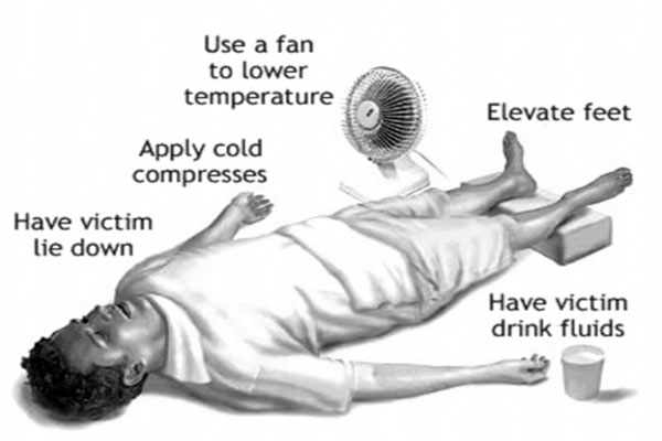হিটস্ট্রোকের লক্ষণ ও করণীয়