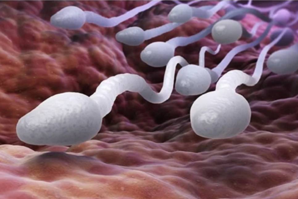 Sperm counts decline globally