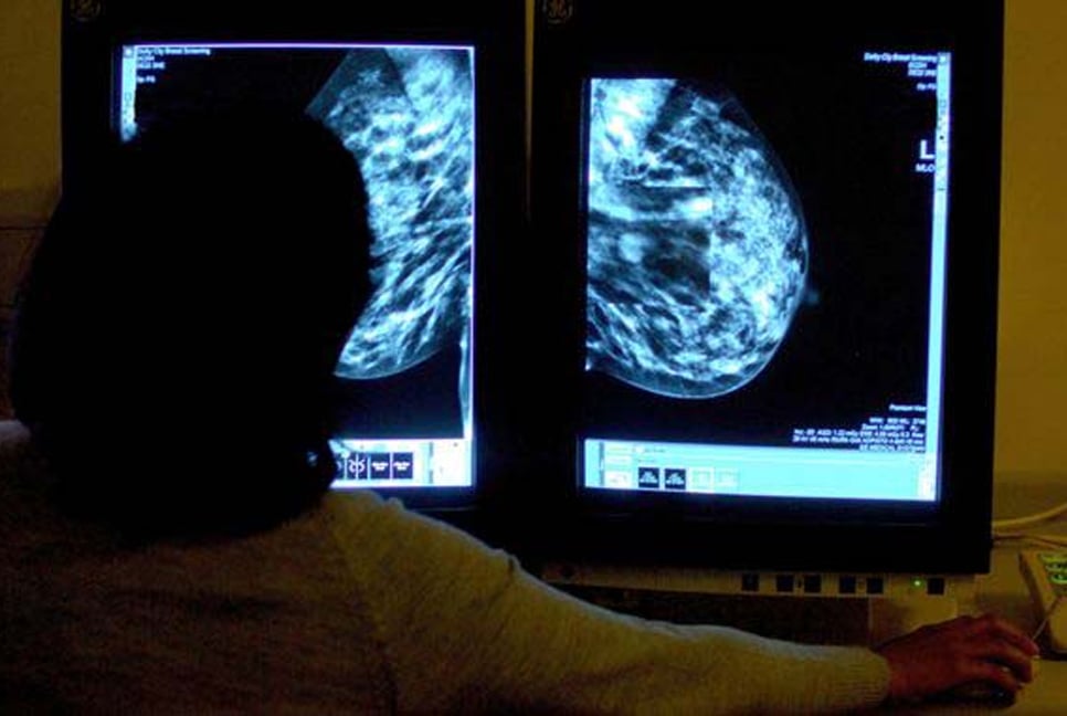 AI could halve time reading breast cancer scans, study suggests